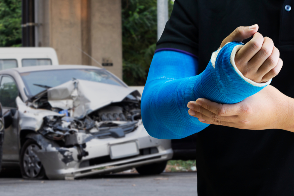 Should I Hire an Attorney for Auto Accident Injuries in New York